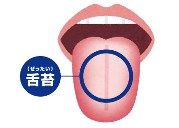 舌苔イメージ